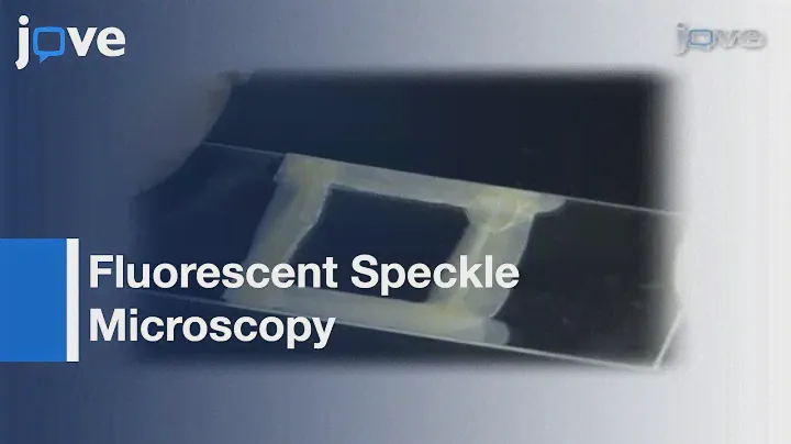 Live Cell Imaging: F-actin Dynamics Via Fluorescent Speckle Microscopy (FSM) l Protocol Preview