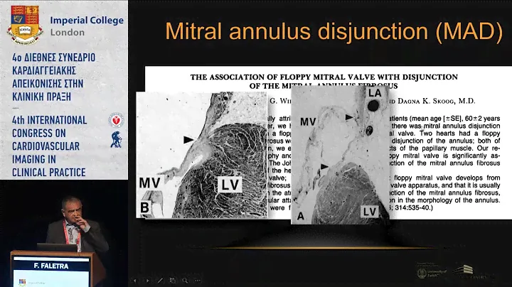 F. Faletra  | Role of imaging in Electrophysiology