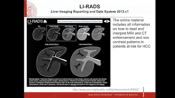 EFSUMB Webinar: CEUS in Liver Imaging 08-04-2020 - F. Piscaglia